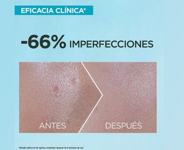 Protector solar para piel con imperfecciones